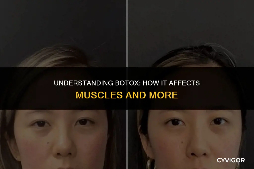 how does botox affect muscles