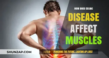 Unveiling the Impact of Celiac Disease on Muscular Health