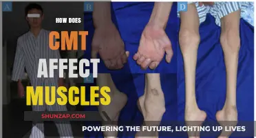 Understanding CMT: How This Condition Impacts Muscle Health