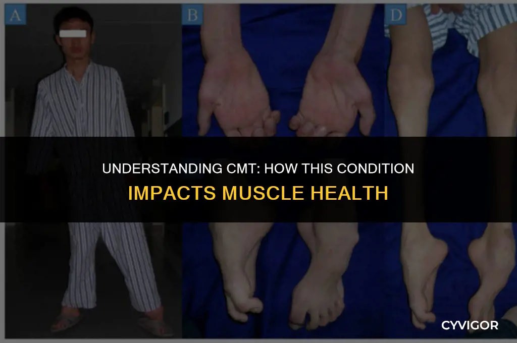 how does cmt affect muscles