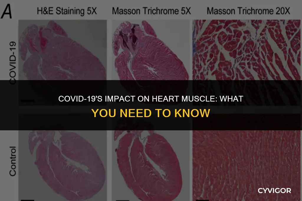 how does covid-19 affect the heart muscle