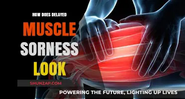 Understanding Delayed Muscle Soreness: Symptoms, Causes, and Recovery Tips