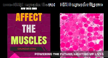Understanding DMD: A Comprehensive Guide to Its Impact on Muscles