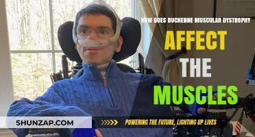 Understanding Duchenne Muscular Dystrophy: A Comprehensive Guide