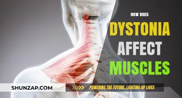 Understanding Dystonia: A Comprehensive Guide to Muscle Impact