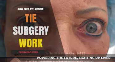 Understanding Eye Muscle Tie Surgery: Procedure, Benefits, and Recovery Explained