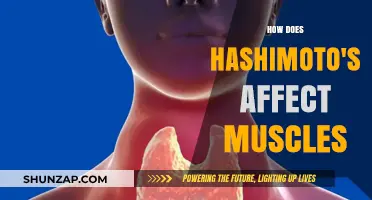 Unveiling the Impact: Hashimoto's Thyroiditis and Muscle Health Explained