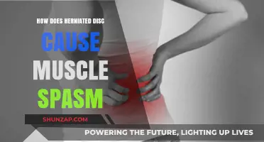 Understanding the Link Between Herniated Discs and Muscle Spasms