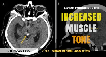Hypernatremia and Muscle Tone: A Salty Affair