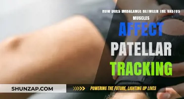 Patellar Tracking: The Impact of Vastus Muscle Imbalance