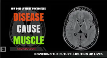 Juvenile Huntington's: Understanding Muscle Degeneration