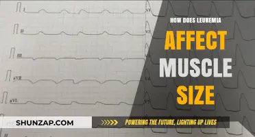 Understanding Leukemia's Impact on Muscle Mass and Strength