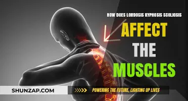 Understanding the Impact of Lordosis, Kyphosis, and Scoliosis on Muscular Health