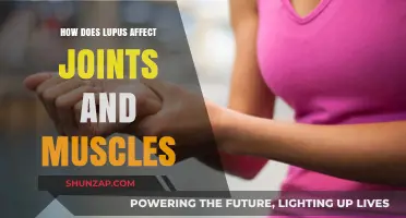 Lupus and Its Impact: Joint and Muscle Health Explained