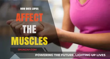 Understanding Lupus: Its Impact on Muscle Health and Function
