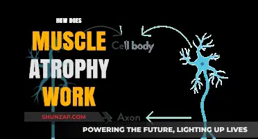Understanding Muscle Atrophy: Causes, Mechanisms, and Prevention Strategies Explained