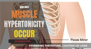 Understanding Muscle Hypertonicity: Causes and Mechanisms