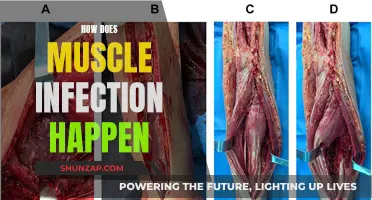 Muscle Infections: Causes and How They Happen