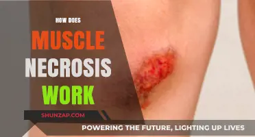 Understanding Muscle Necrosis: Causes, Mechanisms, and Treatment Options