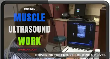 Understanding Muscle Ultrasound: How This Imaging Technology Works