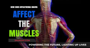 Understanding Myasthenia Gravis: A Comprehensive Guide to Muscle Impact