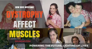 Understanding Myotonic Dystrophy: A Comprehensive Guide to Muscle Impact