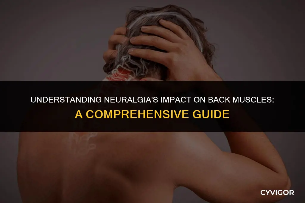 how does neuralgia effect back muscles