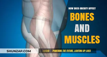 The Impact of Obesity on Bone and Muscle Health