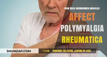 Unraveling the Impact of Overworked Muscles on Polymyalgia Rheumatica