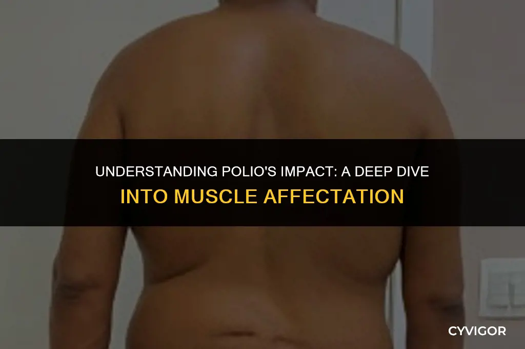 how does polio affect muscle