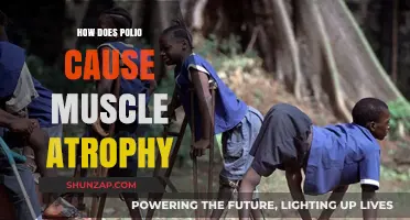 Polio's Impact: Muscle Atrophy Explained