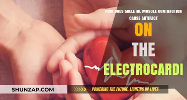 Skeletal Muscle Contraction Artifacts on ECGs Explained
