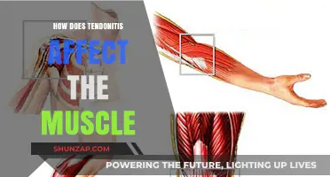 Understanding Tendonitis: Impact on Muscle Health and Function