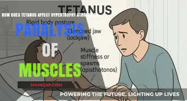 Tetanus: Understanding Muscle Atrophy, Hypertrophy, and Paralysis