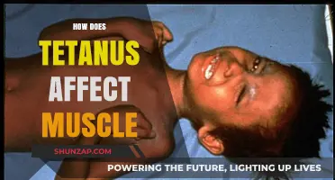 Tetanus: The Silent Culprit Behind Muscle Stiffness and Spasms