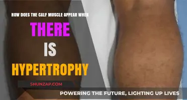 Understanding Calf Muscle Hypertrophy: A Visual Guide