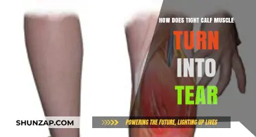 From Tightness to Tears: Understanding Calf Muscle Injuries