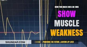 Unveiling the Limits: How Far Back Can an EMG Trace Muscle Weakness?