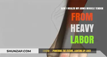 Healing My Arm Muscle Tendon: Recovery Journey After Heavy Labor