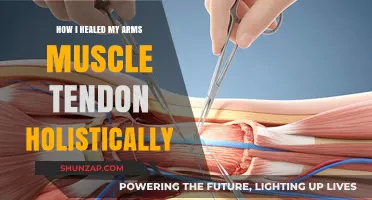 Healing My Arm Muscle Tendon Naturally: A Holistic Recovery Journey