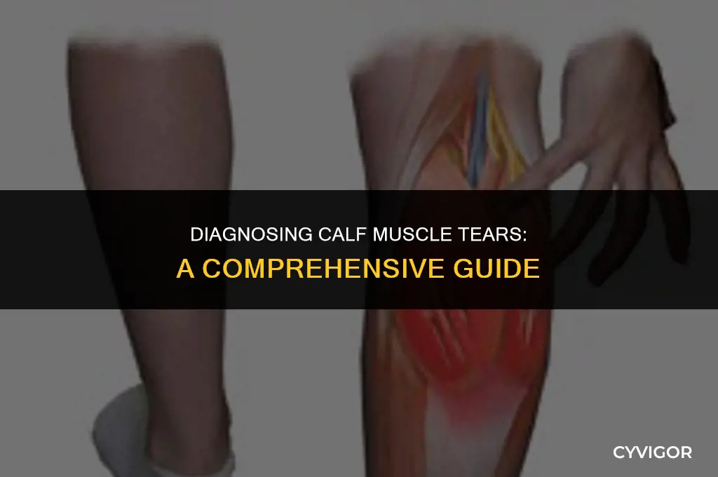 how is a calf muscle tear diagnosed