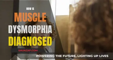 Muscle Dysmorphia: Diagnosis, Symptoms, and Treatment Options