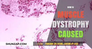 Understanding the Causes of Muscle Dystrophy