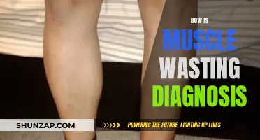 Muscle Wasting: Diagnosis, Tests, and Identification