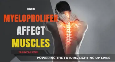 Exploring Myeloproliferative Disorders: Impact on Muscular Health