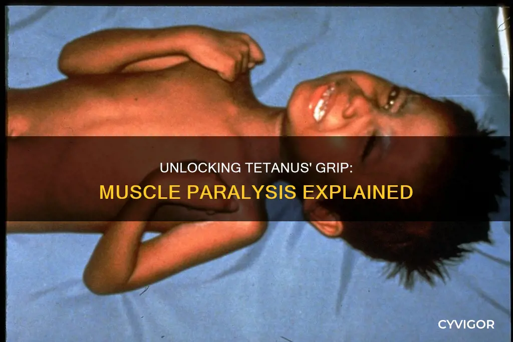 how is tetanus produced muscle