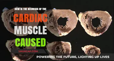 Cardiac Muscle Necrosis: Understanding the Underlying Causes