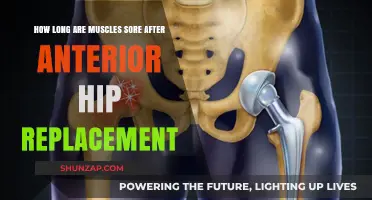 Recovering from Anterior Hip Replacement: Understanding Muscle Soreness Duration