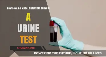 Muscle Relaxers in Urine Tests: Detection Timeframe Explained