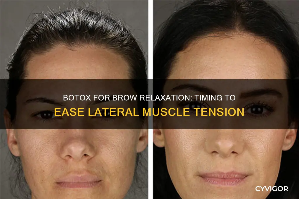 how long for botox to relax lateral muscle brow